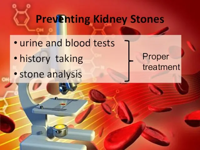 Preventing Kidney Stones urine and blood tests history taking stone analysis Proper treatment