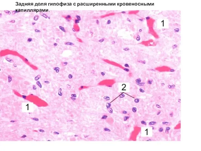 Задняя доля гипофиза с расширенными кровеносными капиллярами.