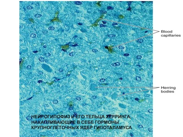 НЕЙРОГИПОФИЗ И ЕГО ТЕЛЬЦА ХЕРРИНГА, НАКАПЛИВАЮЩИЕ В СЕБЕ ГОРМОНЫ КРУПНОГЛЕТОЧНЫХ ЯДЕР ГИПОТАЛАМУСА
