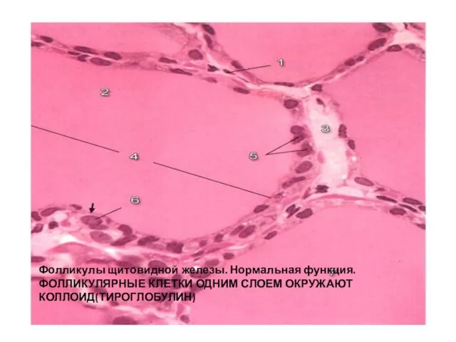 Фолликулы щитовидной железы. Нормальная функция.ФОЛЛИКУЛЯРНЫЕ КЛЕТКИ ОДНИМ СЛОЕМ ОКРУЖАЮТ КОЛЛОИД(ТИРОГЛОБУЛИН)