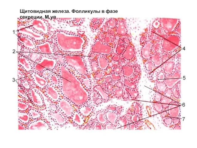 Щитовидная железа. Фолликулы в фазе секреции. М.ув