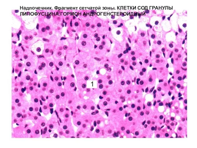 Надпочечник. Фрагмент сетчатой зоны. КЛЕТКИ СОД ГРАНУЛЫ ЛИПОФУСЦИНА.ГОРМОН АНДРОГЕНСТЕРОИДНЫЙ
