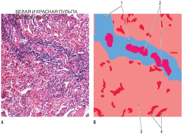 БЕЛАЯ И КРАСНАЯ ПУЛЬПА СЕЛЕЗЕНКИ(?)