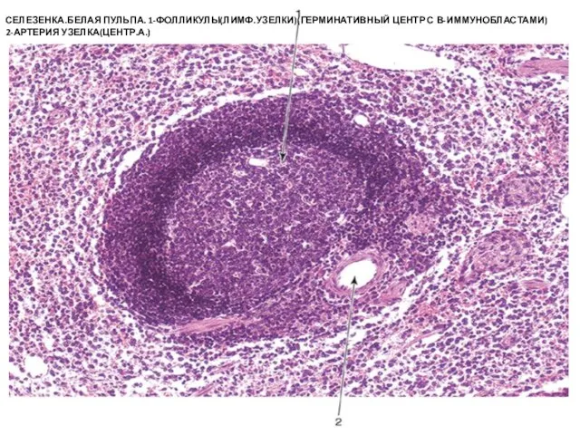 СЕЛЕЗЕНКА.БЕЛАЯ ПУЛЬПА. 1-ФОЛЛИКУЛЫ(ЛИМФ.УЗЕЛКИ)(ГЕРМИНАТИВНЫЙ ЦЕНТР С В-ИММУНОБЛАСТАМИ) 2-АРТЕРИЯ УЗЕЛКА(ЦЕНТР.А.)