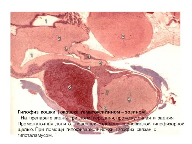 Гипофиз кошки ( окраска гематоксилином – эозином). На препарате видны три доли: