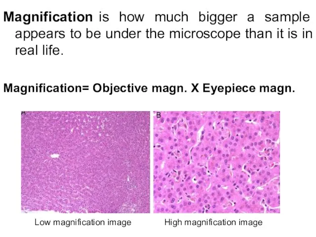 Magnification is how much bigger a sample appears to be under the