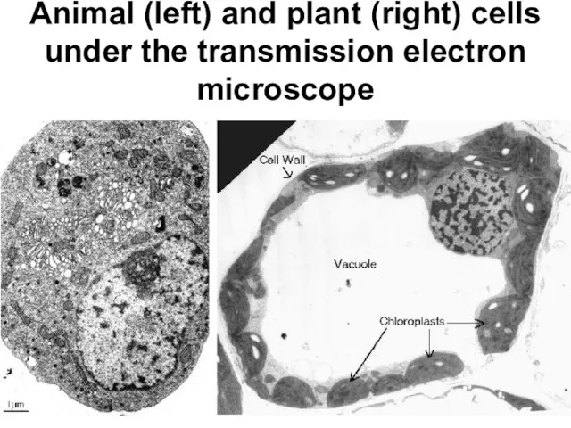 Animal (left) and plant (right) cells under the transmission electron microscope