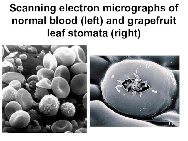 Scanning electron micrographs of normal blood (left) and grapefruit leaf stomata (right)