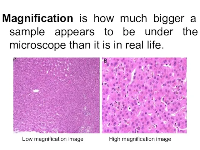 Magnification is how much bigger a sample appears to be under the