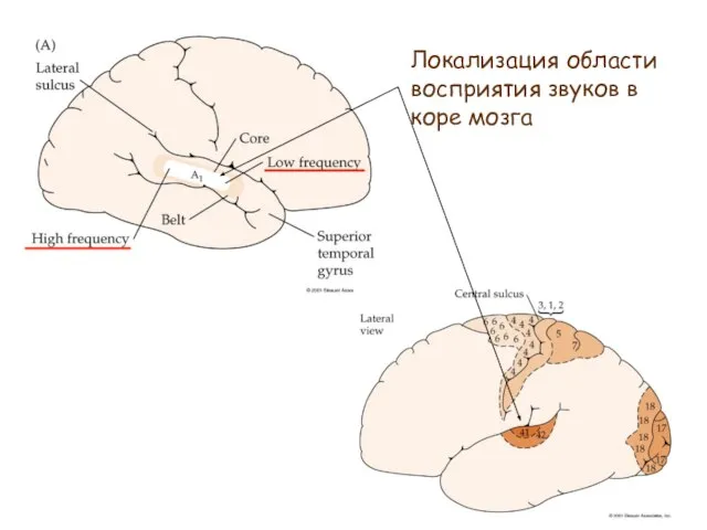 Локализация области восприятия звуков в коре мозга