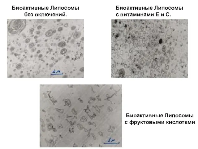 Биоактивные Липосомы без включений. Биоактивные Липосомы с витаминами Е и С. Биоактивные Липосомы с фруктовыми кислотами
