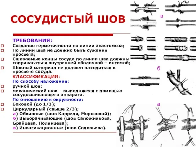 СОСУДИСТЫЙ ШОВ ТРЕБОВАНИЯ: Создание герметичности по линии анастомоза; По линии шва не