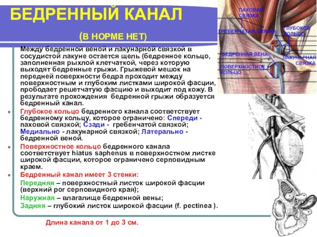 БЕДРЕННЫЙ КАНАЛ (В НОРМЕ НЕТ) Между бедренной веной и лакунарной связкой в