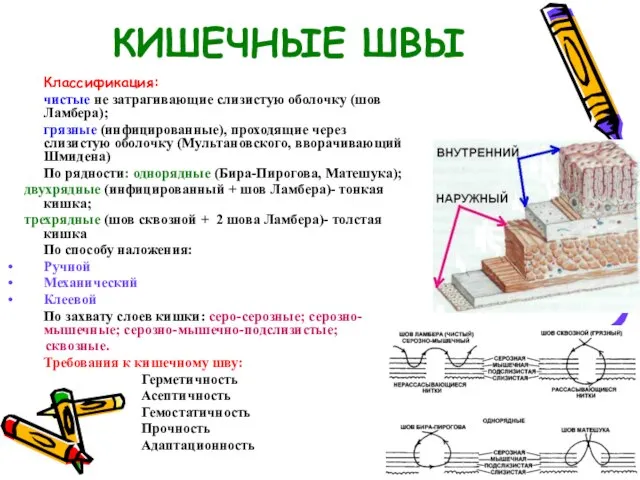 КИШЕЧНЫЕ ШВЫ Классификация: чистые не затрагивающие слизистую оболочку (шов Ламбера); грязные (инфицированные),