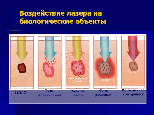 Воздействие лазера на биологические объекты