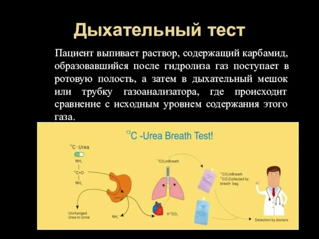 Дыхательный тест Пациент выпивает раствор, содержащий карбамид, образовавшийся после гидролиза газ поступает