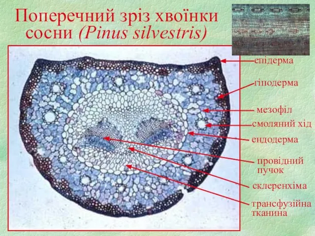 Поперечний зріз хвоїнки сосни (Pinus silvestris) епідерма гіподерма мезофіл смоляний хід ендодерма