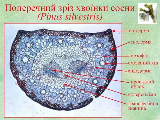 Поперечний зріз хвоїнки сосни (Pinus silvestris) епідерма гіподерма мезофіл смоляний хід ендодерма