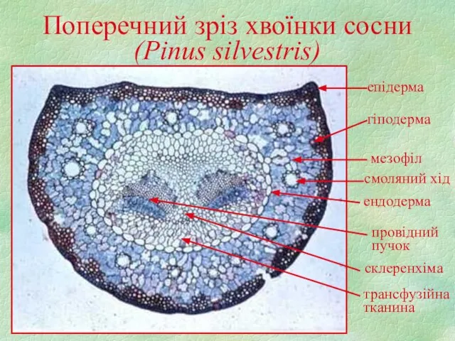 Поперечний зріз хвоїнки сосни (Pinus silvestris) епідерма гіподерма мезофіл смоляний хід ендодерма