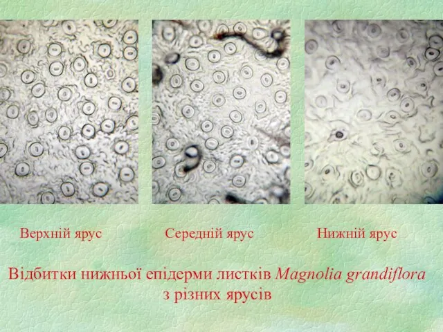 Верхній ярус Середній ярус Нижній ярус Відбитки нижньої епідерми листків Magnolia grandiflora з різних ярусів