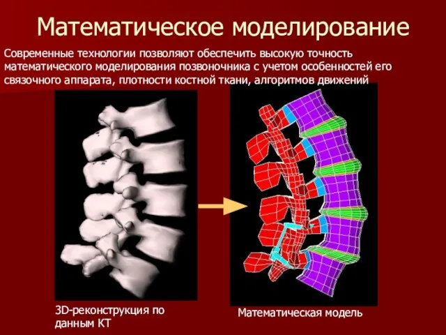 Математическое моделирование Современные технологии позволяют обеспечить высокую точность математического моделирования позвоночника с