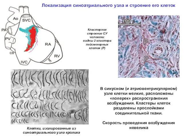 Кластерное строение СУ человека: видны 2 кластера пейсмекерных клеток (Р) Локализация синоатриального