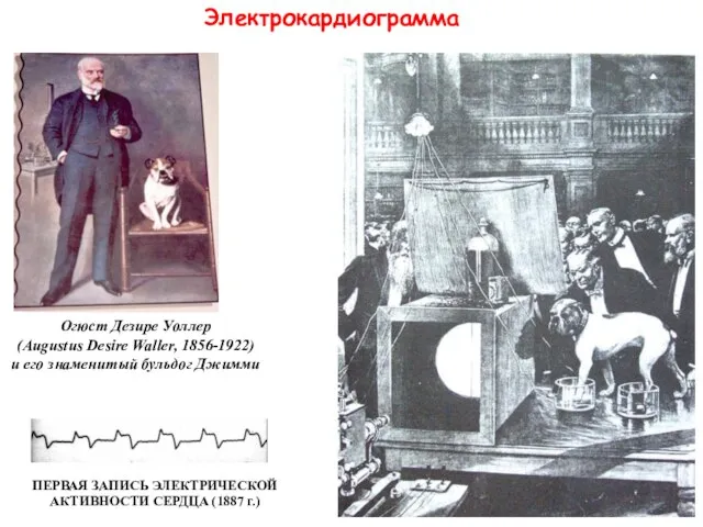 Электрокардиограмма Огюст Дезире Уоллер (Augustus Desire Waller, 1856-1922) и его знаменитый бульдог