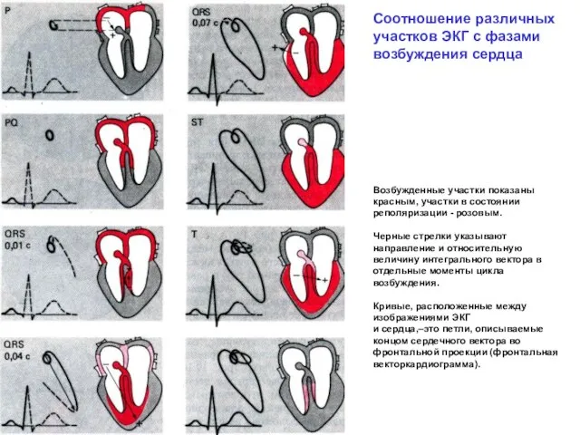 Соотношение различных участков ЭКГ с фазами возбуждения сердца Возбужденные участки показаны красным,