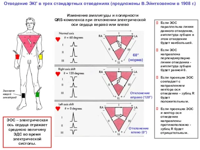 Отведение ЭКГ в трех стандартных отведениях (предложены В.Эйнтховеном в 1908 г.) Изменение