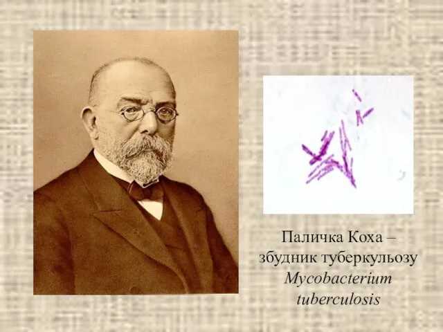 Паличка Коха – збудник туберкульозу Mycobacterium tuberculosis