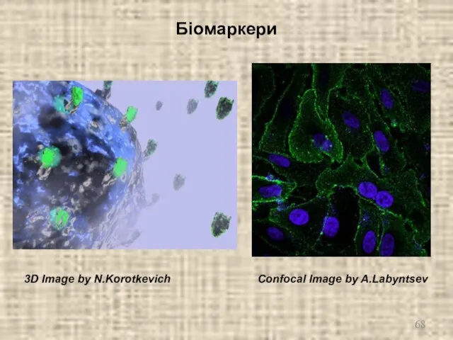 Біомаркери Confocal Image by A.Labyntsev 3D Image by N.Korotkevich