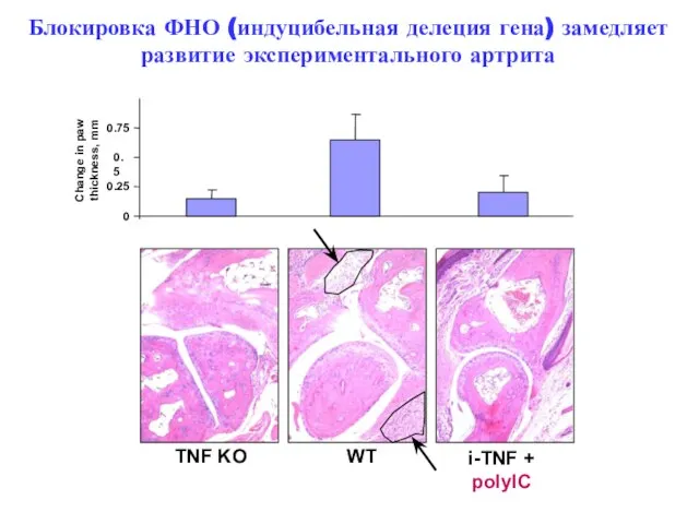 Блокировка ФНО (индуцибельная делеция гена) замедляет развитие экспериментального артрита WT i-TNF +