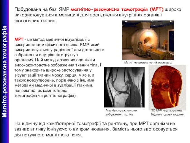 Магніто-резонансна томографія Побудована на базі ЯМР магнітно-резонансна томографія (МРТ) широко використовується в