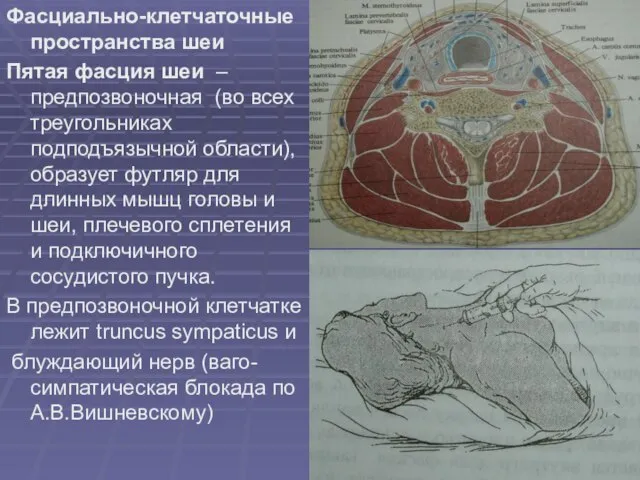 Фасциально-клетчаточные пространства шеи Пятая фасция шеи – предпозвоночная (во всех треугольниках подподъязычной