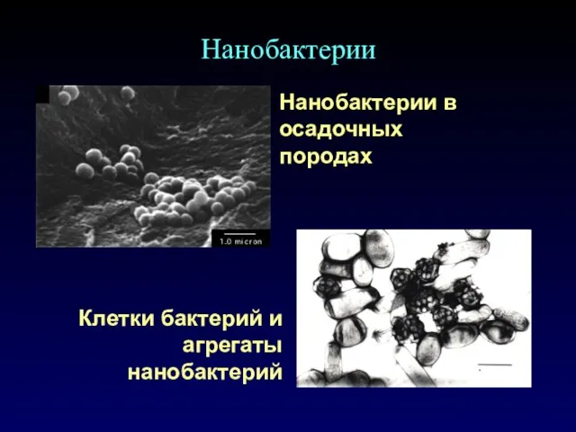 Нанобактерии в осадочных породах Нанобактерии Клетки бактерий и агрегаты нанобактерий