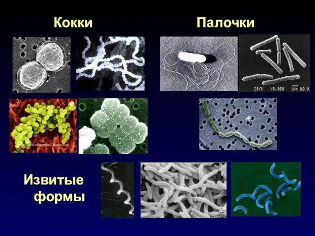 Кокки Палочки Извитые формы