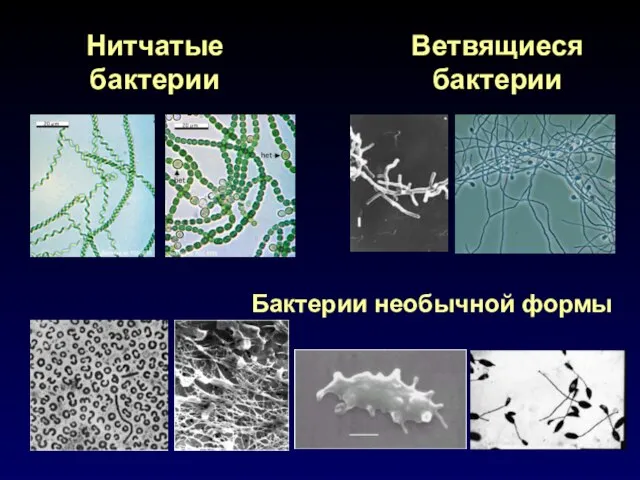 Нитчатые бактерии Ветвящиеся бактерии Бактерии необычной формы