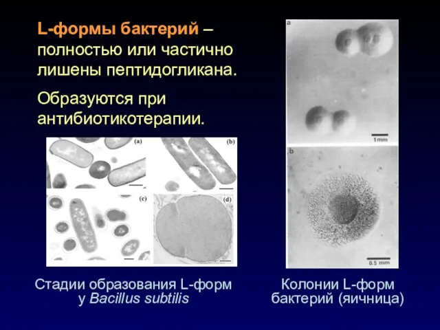 L-формы бактерий – полностью или частично лишены пептидогликана. Образуются при антибиотикотерапии. Стадии