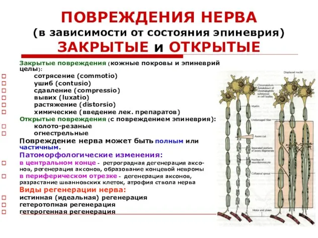 ПОВРЕЖДЕНИЯ НЕРВА (в зависимости от состояния эпиневрия) ЗАКРЫТЫЕ и ОТКРЫТЫЕ Закрытые повреждения