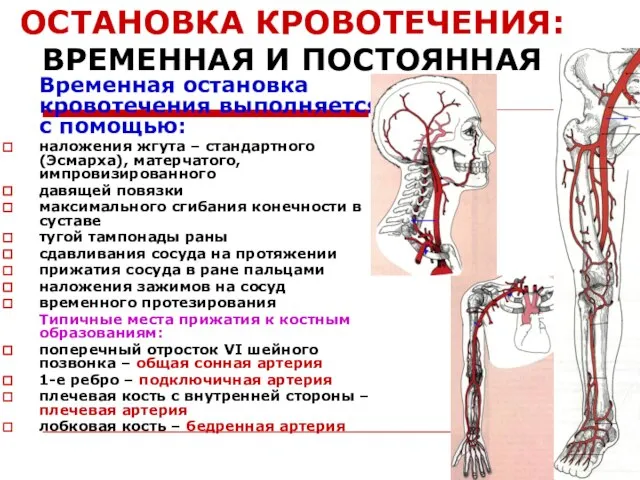 ОСТАНОВКА КРОВОТЕЧЕНИЯ: ВРЕМЕННАЯ И ПОСТОЯННАЯ Временная остановка кровотечения выполняется с помощью: наложения