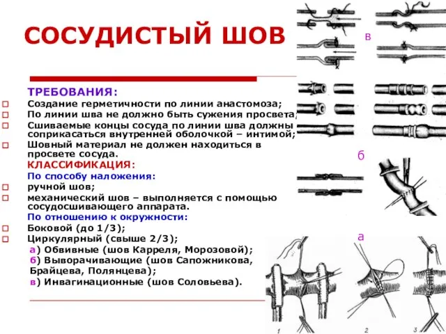 СОСУДИСТЫЙ ШОВ ТРЕБОВАНИЯ: Создание герметичности по линии анастомоза; По линии шва не