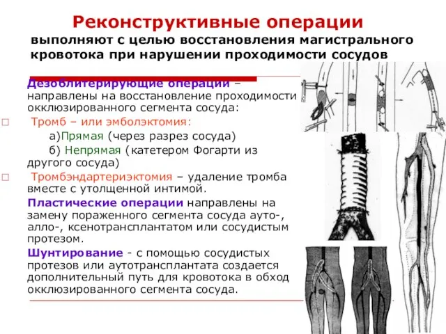 Реконструктивные операции выполняют с целью восстановления магистрального кровотока при нарушении проходимости сосудов