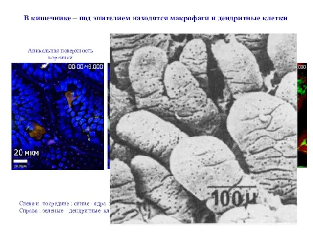 В кишечнике – под эпителием находятся макрофаги и дендритные клетки 20 мкм