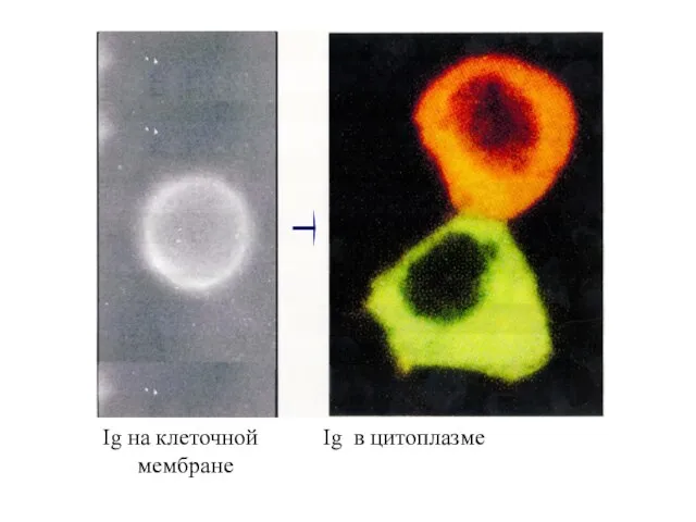Ig на клеточной Ig в цитоплазме мембране
