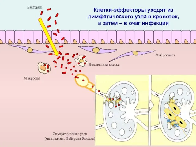 Макрофаг Дендритная клетка Фибробласт Лимфатический узел (миндалина, Пейерова бляшка) Бактерии Клетки-эффекторы уходят