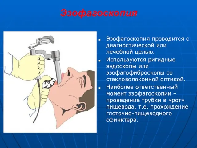 Эзофагоскопия Эзофагоскопия проводится с диагностической или лечебной целью. Используются ригидные эндоскопы или