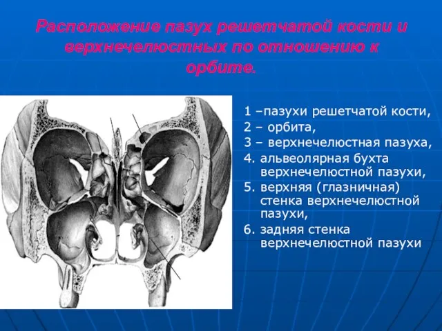 Расположение пазух решетчатой кости и верхнечелюстных по отношению к орбите. 1 –пазухи