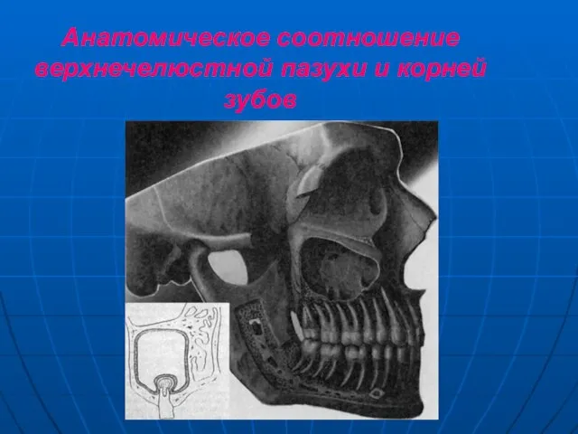 Анатомическое соотношение верхнечелюстной пазухи и корней зубов