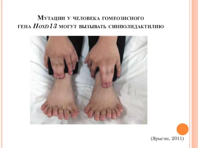 Мутации у человека гомеозисного гена Нохd13 могут вызывать синполидактилию (Ярыгин, 2011)