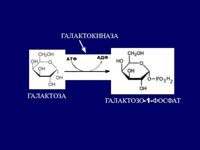 ГАЛАКТОЗА ГАЛАКТОЗО-1-ФОСФАТ ГАЛАКТОКИНАЗА